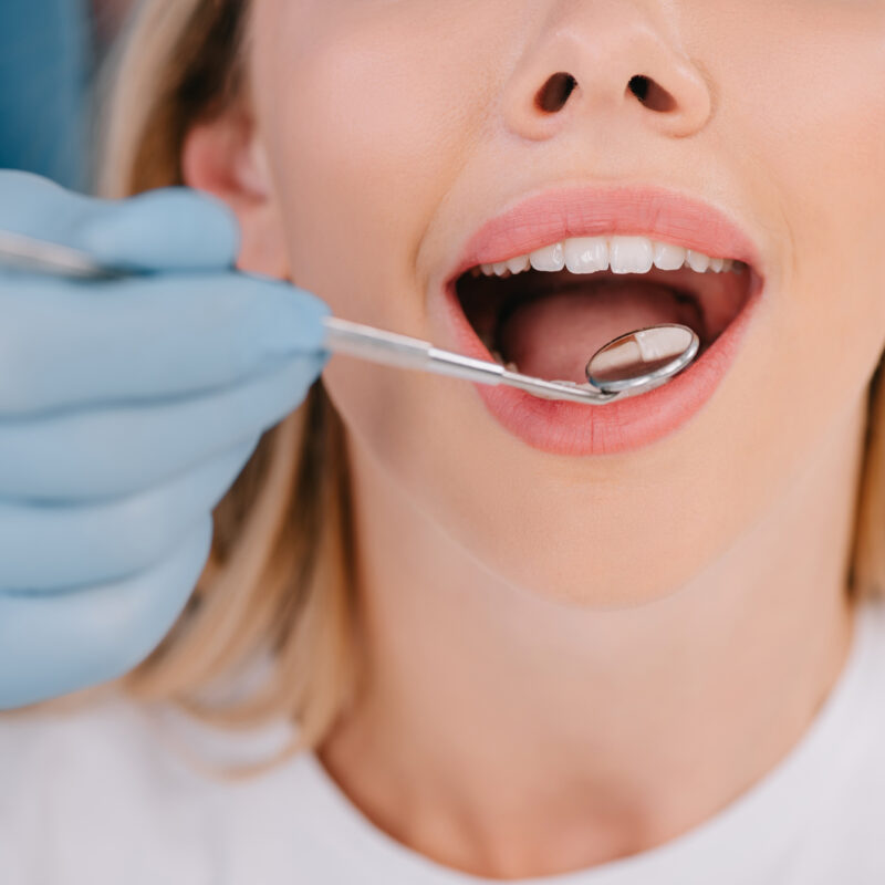 dentist checking woman's teeth with a dental mirror