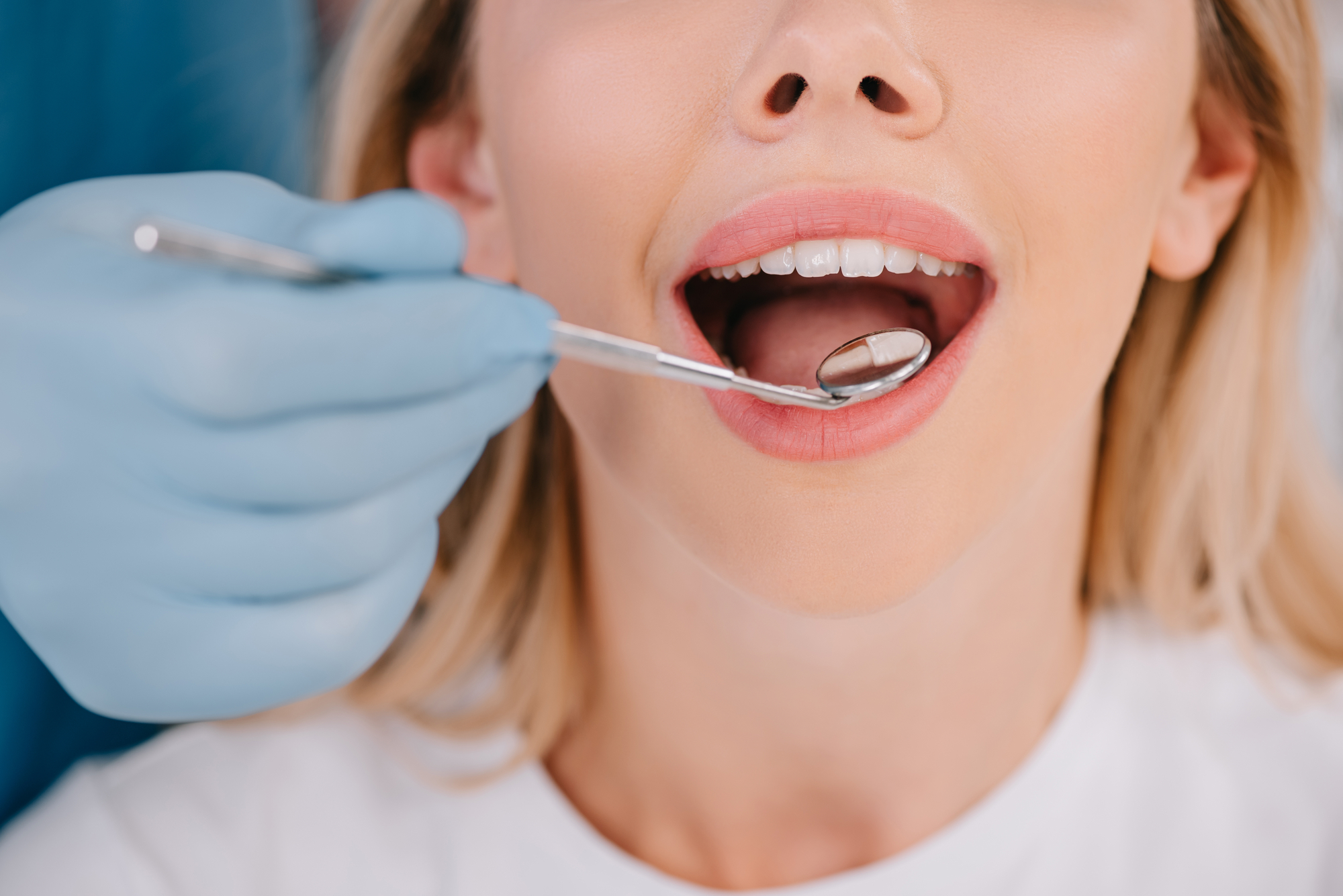 The Consequences of Skipping Dental Exams: More Than Just a Check-Up