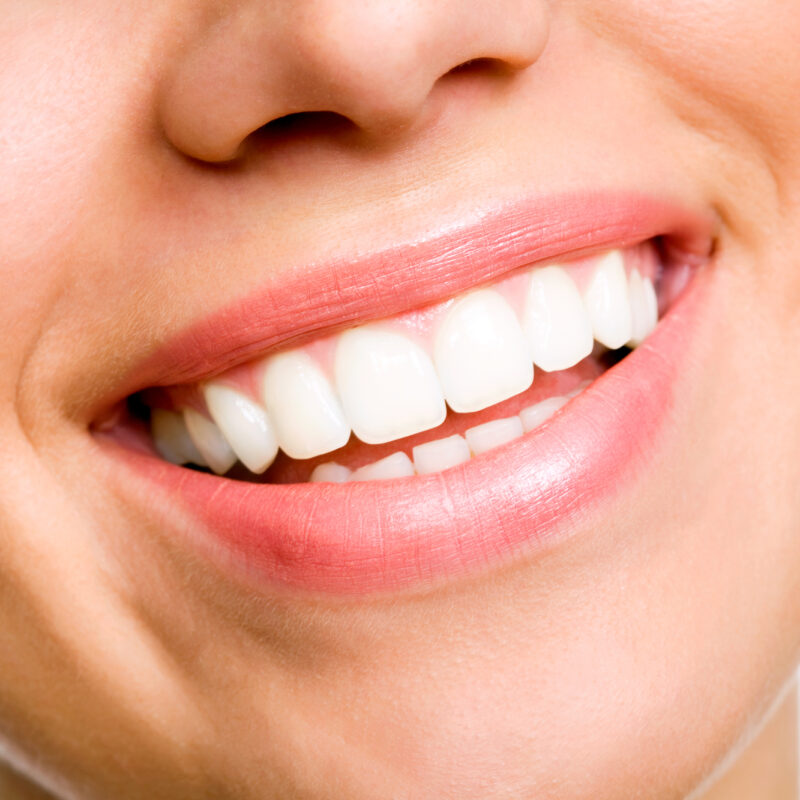 close up of woman's perfect smile