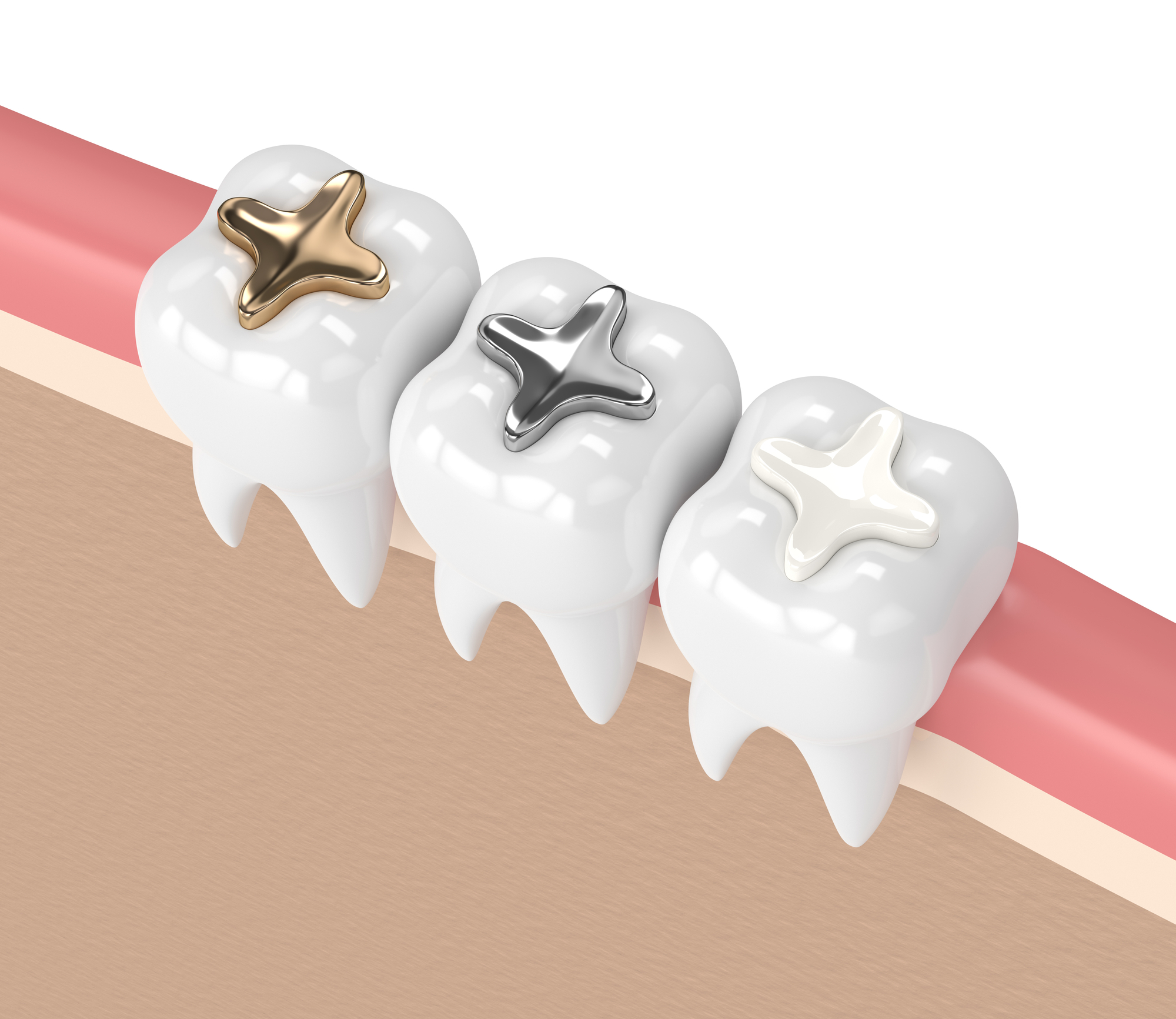 The Many Surprising Uses of Cavity Fillings