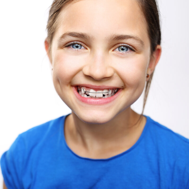 young girl with crooked teeth, blue shirt, blue eyes, brown hair, and white background