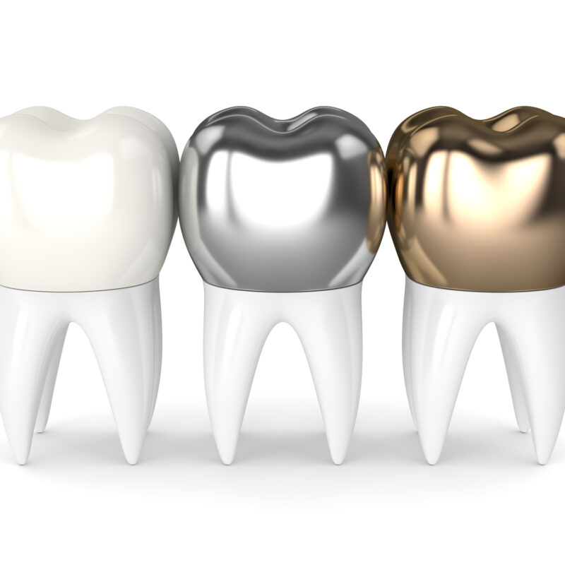 3d render of teeth with gold, amalgam and composite dental crowns over white background