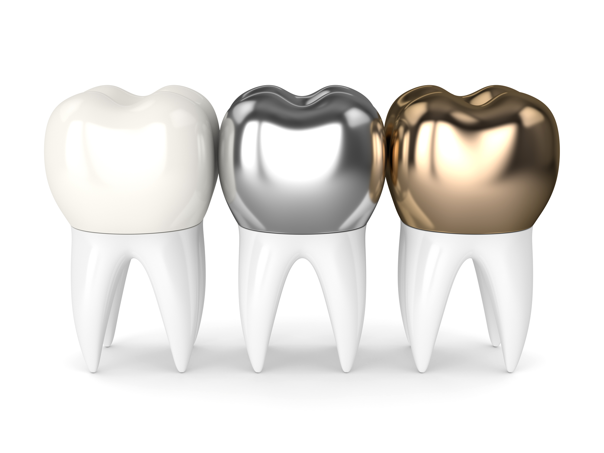 Exploring the World of Dental Crowns: Types and Costs