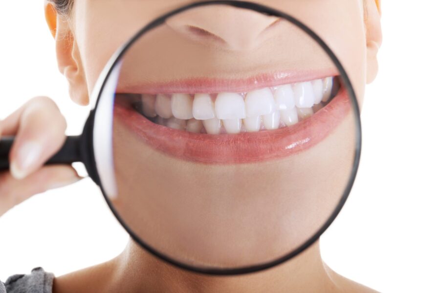 magnifying glass over woman's smile with veneers