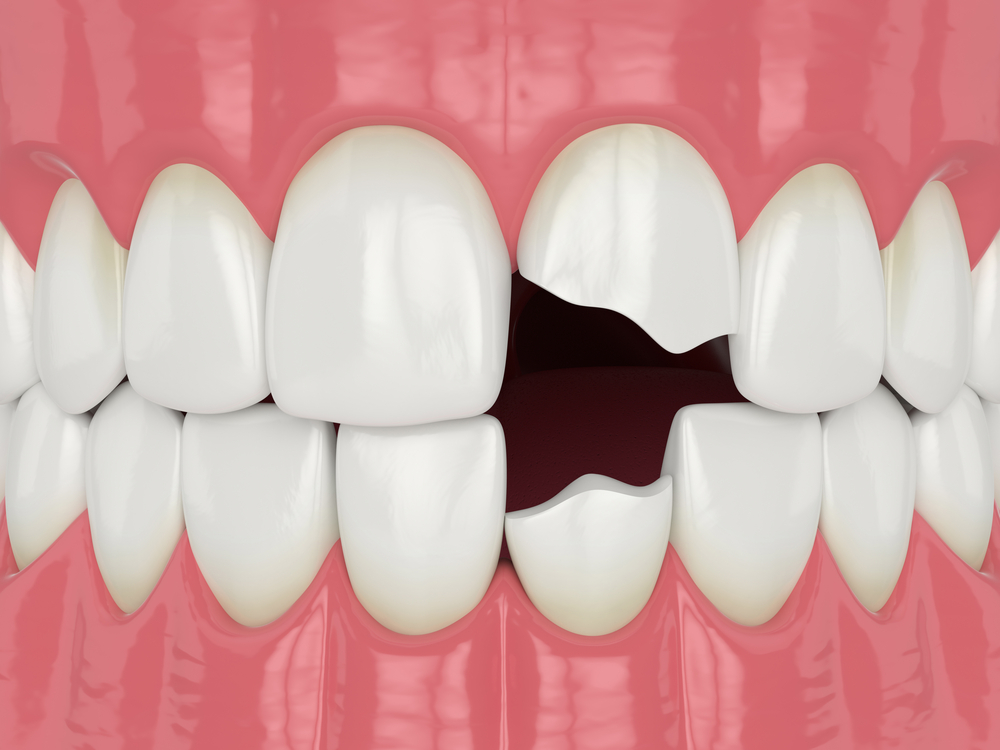 Need a dentist, stat? Examples of Dental Emergencies