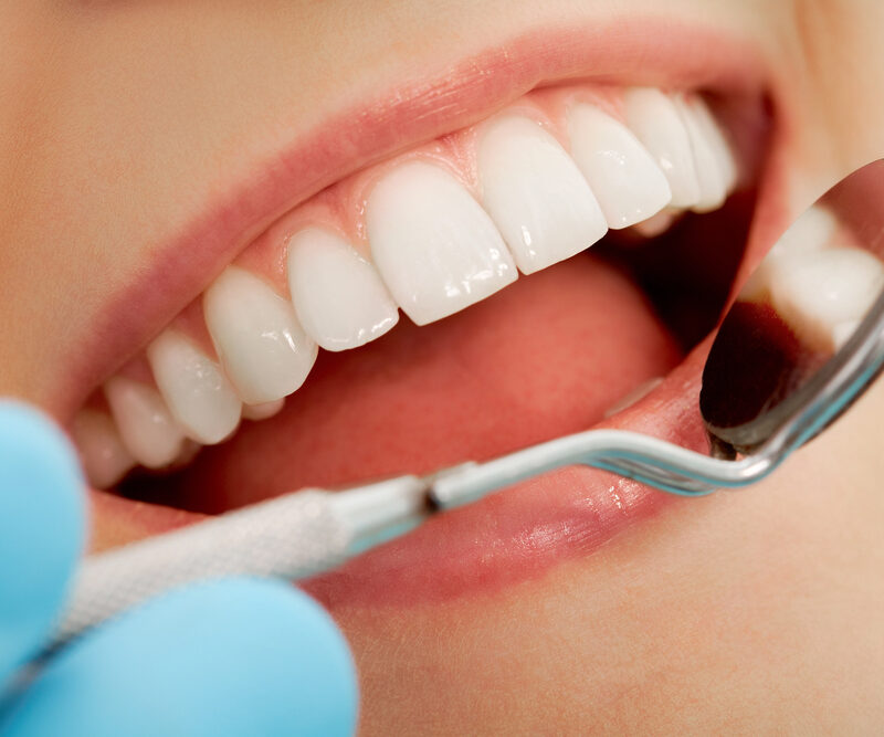 close up of woman opening her mouth during a dental checkup, dentist holding dental mirror up to teeth