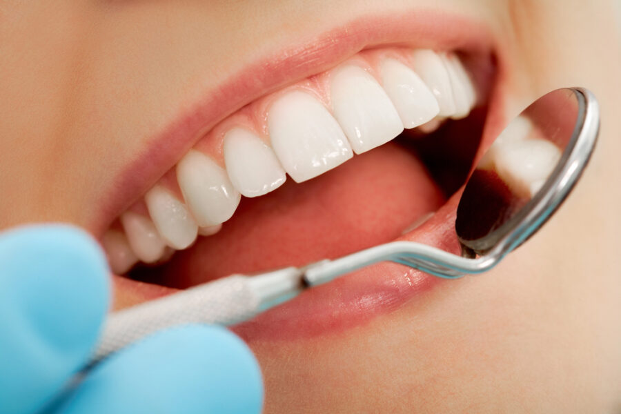 close up of woman opening her mouth during a dental checkup, dentist holding dental mirror up to teeth