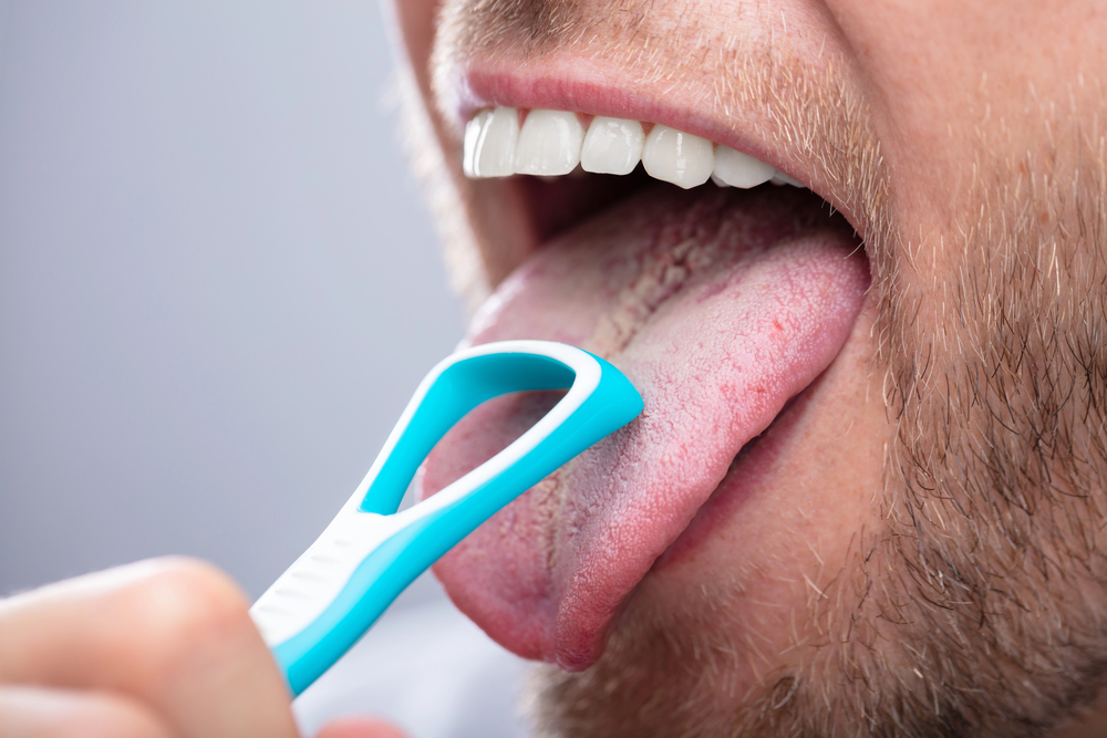 Ask a General Dentist in Mission, BC: Is Tongue Scraping Really That Important?