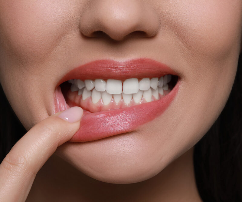 close up of woman pulling down her bottom lip to show her gums