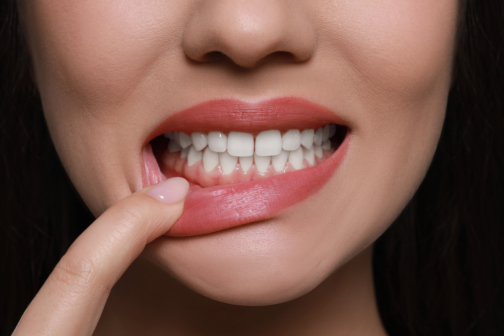 The Link Between Gum Disease and Skipping Dental Checkups