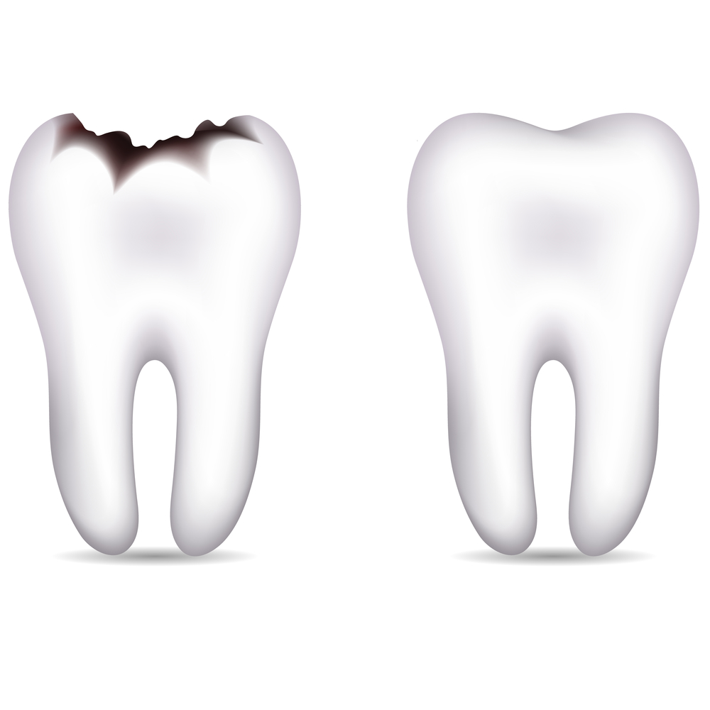 From Cavities to Crowns: Why Restorative Dentistry Matters More Than You Think
