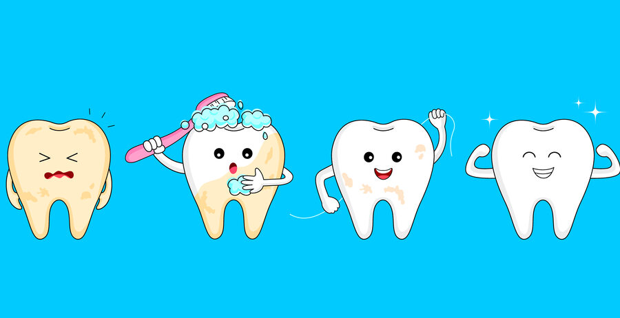 Four steps of cleaning tooth. Cartoon tooth character design, before and after. Whitening teeth, dental care concept.