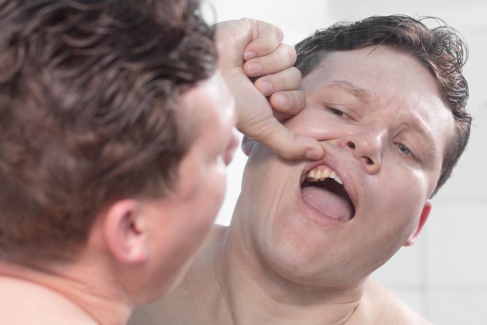 I Scraped My Tooth, Will It Smooth Out and Heal on Its Own?