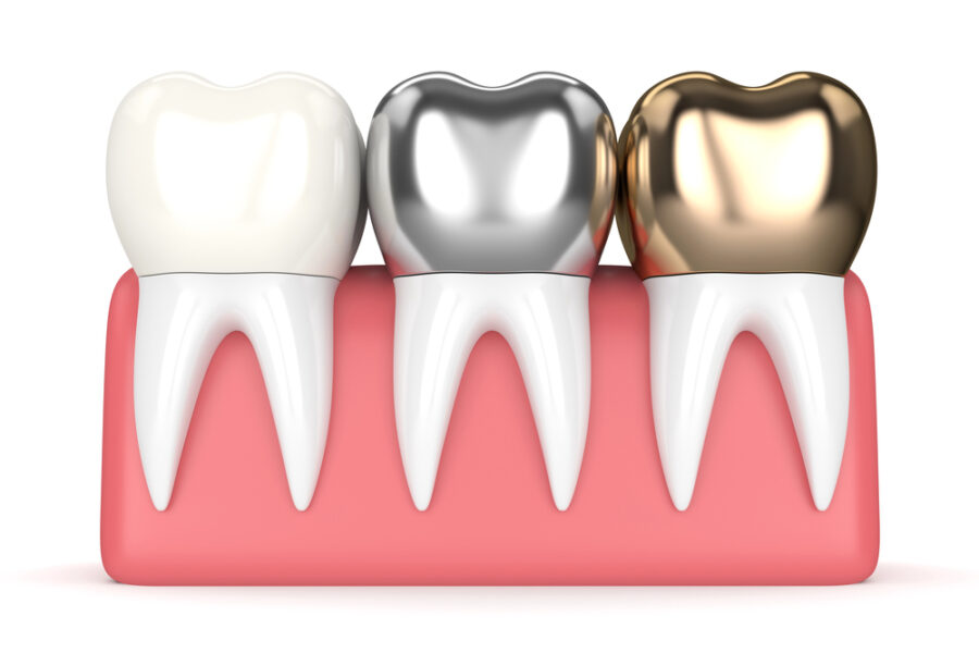 dental crowns